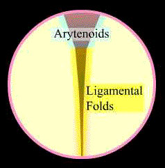 Arytenoids